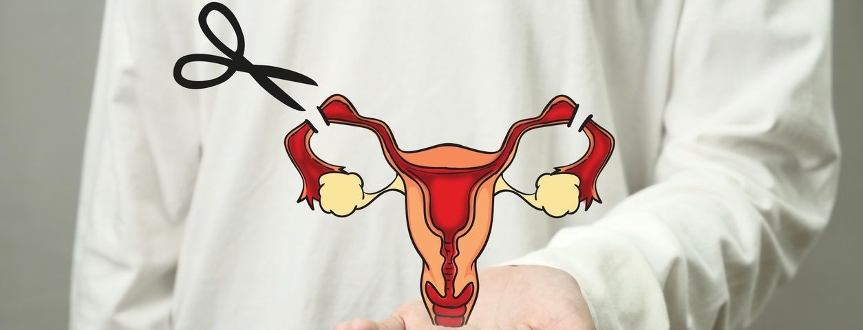 Sterilisation image
